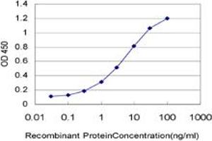 Detection limit for recombinant GST tagged RCV1 is approximately 0. (Recoverin antibody  (AA 101-199))