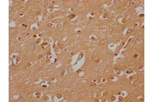 IHC image of ABIN7142045 diluted at 1:200 and staining in paraffin-embedded human brain tissue performed on a Leica BondTM system. (Phospholipase C beta 2 antibody  (AA 1031-1185))