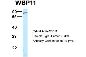 Host:  Rabbit  Target Name:  WB Sample Type:  Jurkat  Antibody Dilution:  1. (WBP11 antibody  (N-Term))