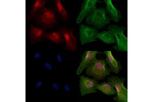 Phospho-TOPBP1 (Ser1138) Antibody staining A549 cells(heat shock treatment) by IF/ICC.