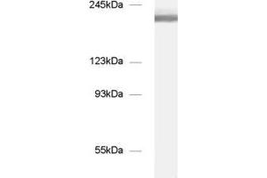 dilution: 1 : 1000, sample: mouse brain homogenate (NCAM 180 (AA 1-1115) antibody)