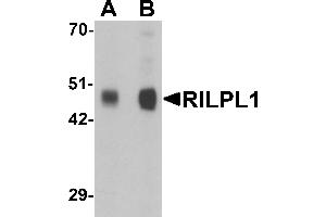 Western blot analysis of RILPL1 in rat cerebellum tissue lysate with RILPL1 antibody at (A) 0. (RILPL1 antibody  (N-Term))