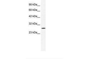 Image no. 2 for anti-Chloride Intracellular Channel 1 (CLIC1) (AA 62-111) antibody (ABIN202109)