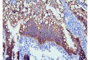 IHC analysis of PYROXD1 using anti-PYROXD1 antibody (ABIN6719650). (PYROXD1 antibody  (AA 48-230))