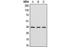 Western blot analysis of Cathepsin V expression in HeLa (A), mouse kidney (B), rat kidney (C) whole cell lysates.