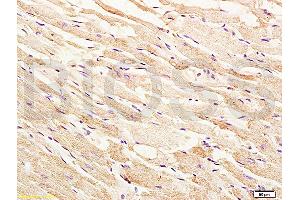 Formalin-fixed and paraffin embedded rat heart tissue labeled with Anti-phospho-ASK1(Thr845) Polyclonal Antibody, Unconjugated (ABIN683128) at 1:200 followed by conjugation to the secondary antibody, (SP-0023), and DAB staining (ASK1 antibody  (pThr845))