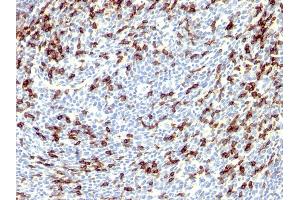 Formalin-fixed, paraffin-embedded human Tonsil stained with PD1 (CD279) Rabbit Polyclonal Antibody. (PD-1 antibody)