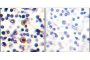 Immunohistochemistry analysis of paraffin-embedded human lymph node, using IL-9R (Phospho-Ser519) Antibody. (IL9 Receptor antibody  (pSer519))