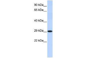 WB Suggested Anti-HSD17B14 Antibody Titration: 0. (HSD17B14 antibody  (Middle Region))