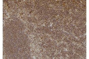 ABIN6276920 at 1/100 staining Mouse spleen tissue by IHC-P. (Liver Arginase antibody  (C-Term))