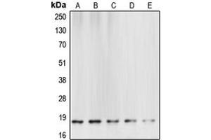 Western blot analysis of Caspase 6 p18 expression in HeLa (A), mouse brain (B), rat kidney (C), NIH3T3 staurosporine-treated (D), Jurkat etoposide-treated (E) whole cell lysates. (Caspase 6 p18 (Center) antibody)