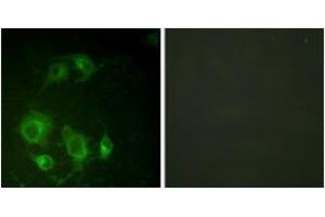 Immunofluorescence analysis of HuvEc cells, using EGFR (Ab-693) Antibody.