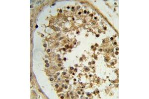 I mmunohistochemistry analysis of human testis tissue (Formalin-fixed, Paraffin-embedded) using ELOVL2  Antibody  (N-term),  peroxidase-conjugated to the secondary antibody, followed by DAB staining. (ELOVL2 antibody  (N-Term))