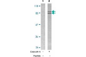 Western blot analysis of extract from SW 626 cells, using CTNNB1 (phospho S37) polyclonal antibody . (CTNNB1 antibody  (pSer37))