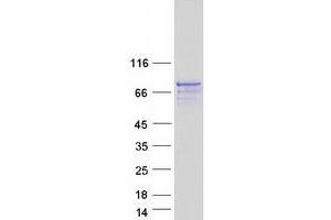 Validation with Western Blot (AMER2 Protein (Transcript Variant 2) (Myc-DYKDDDDK Tag))