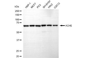 Western blotting analysis using ACHE antibody (ABIN7797446).