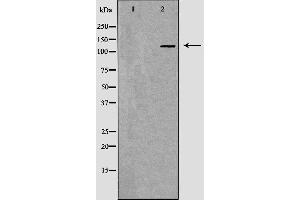 Western blot analysis of Hela whole cell lysates, using MSH3 Antibody. (MSH3 antibody  (N-Term))