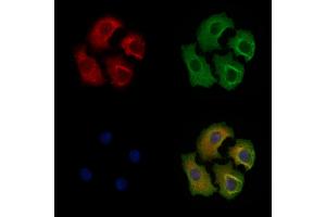 Phospho-eIF4B (Ser504) Antibody staining Hela cells(heat shock treatment) by IF/ICC.