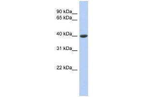 Carboxypeptidase B1 antibody used at 1 ug/ml to detect target protein. (CPB1 antibody)