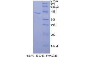 SDS-PAGE analysis of Human HIST1H2AG Protein. (HIST1H2AG Protein)
