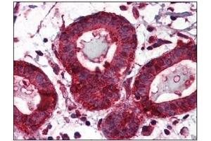 Immunohistochemistry (IHC) image for anti-Heat Shock Protein 90kDa beta (Grp94), Member 1 (HSP90B1) (AA 676-803) antibody (ABIN317570) (GRP94 antibody  (AA 676-803))