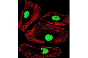 Fluorescent confocal image of Hela cell stained with MBD2 Antibody (Center) (ABIN1881531 and ABIN2838849).