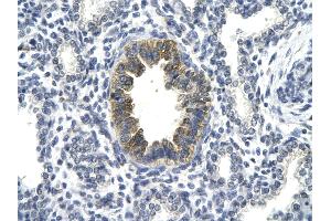 Rabbit Anti-TP53 antibody Catalog Number: AVARP02055  Paraffin Embedded Tissue: Human Lung cell Cellular Data: bronchiole epithelium of renal tubule Antibody Concentration: 4. (p53 antibody  (C-Term))