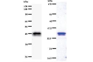Left: CHD1L staining. (CHD1L antibody)