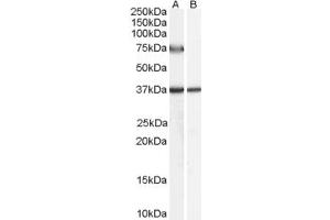 Western Blotting (WB) image for anti-Acyl-CoA Oxidase 2, Branched Chain (Acox2) (AA 651-664) antibody (ABIN291240) (Acox2 antibody  (AA 651-664))