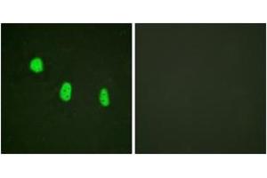 Immunofluorescence analysis of HeLa cells, using C/EBP-epsilon (Phospho-Thr74) Antibody. (CEBPE antibody  (pThr74))