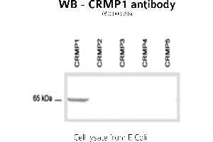 Image no. 2 for anti-GABA Transporter 1 (GAT1) (C-Term) antibody (ABIN346940)