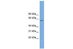 WB Suggested Anti-ZBTB46 Antibody Titration:  0. (ZBTB46 antibody  (Middle Region))
