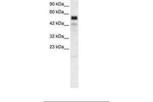 Image no. 3 for anti-T-Bet (AA 338-387) antibody (ABIN6735814)