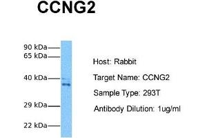 Host: Rabbit Target Name: CCNG2 Sample Tissue: Human 293T Antibody Dilution: 1. (Cyclin G2 antibody  (N-Term))