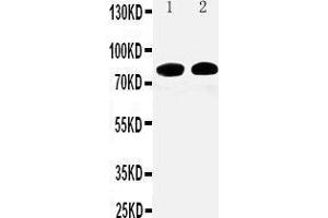 Anti-Calpain 1 antibody, Western blotting Lane 1:  Cell Lysate Lane 2: COLO320 Cell Lysate