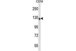 Western blot analysis of KCNH2 Antibody (Center) in CEM cell line lysates (35ug/lane). (KCNH2 antibody  (Middle Region))
