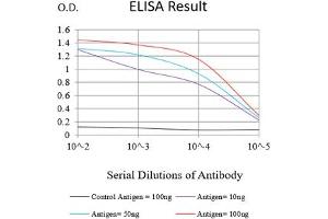 Black line: Control Antigen (100 ng),Purple line: Antigen (10 ng), Blue line: Antigen (50 ng), Red line:Antigen (100 ng) (HAS1 antibody)