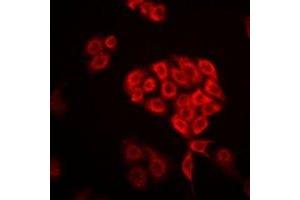 Immunofluorescent analysis of DHRS9 staining in Hela cells. (DHRS9 antibody)