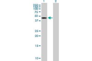 Western Blot analysis of ZMYND10 expression in transfected 293T cell line by ZMYND10 MaxPab polyclonal antibody. (ZMYND10 antibody  (AA 1-440))