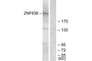 Western blot analysis of extracts from HepG2 cells, treated with serum (20%, 15mins), using ZNF638 antibody. (ZNF638 antibody  (Internal Region))