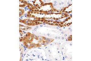 Paraformaldehyde-fixed, paraffin embedded human kidney tissue, Antigen retrieval by boiling in sodium citrate buffer (pH6. (UCHL1 antibody)
