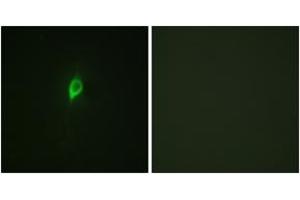 Immunofluorescence analysis of NIH-3T3 cells, using eIF4B (Phospho-Ser422) Antibody. (EIF4B antibody  (pSer422))