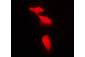 Immunofluorescent analysis of PPP2R5A staining in NIH3T3 cells. (PPP2R5A antibody  (Center))