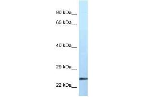 Western Blot showing EFNA2 antibody used at a concentration of 1 ug/ml against Placenta Lysate