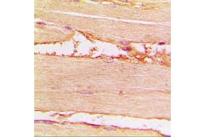 Immunohistochemical analysis of Merlin (pS518) staining in human muscle formalin fixed paraffin embedded tissue section. (Merlin antibody  (C-Term, pSer518))