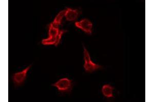 ABIN6267415 staining Hela by IF/ICC. (FLT1 antibody  (pTyr1213))