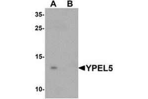 Western blot analysis of YPEL5 in A-20 cell lysate with YPEL5 Antibody  at 1 ug/mL in (A) the absence and (B) the presence of blocking peptide. (YPEL5 antibody  (N-Term))