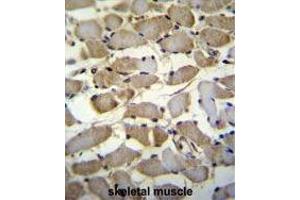 ZMYND17 Antibody (C-term) immunohistochemistry analysis in formalin fixed and paraffin embedded human skeletal muscle followed by peroxidase conjugation of the secondary antibody and DAB staining. (ZMYND17 antibody  (C-Term))