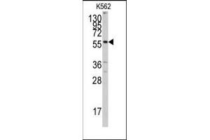 Image no. 1 for anti-Cytochrome P450, Family 7, Subfamily A, Polypeptide 1 (CYP7A1) (C-Term) antibody (ABIN360417) (CYP7A1 antibody  (C-Term))