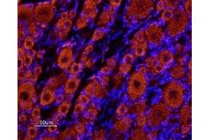 Expression of KCNK18 in rat dorsal root ganglia - Immunohistochemical staining of rat dorsal root ganglia (DRG) frozen sections using Anti-KCNK18 (TRESK) (extracellular) Antibody (ABIN7043446, ABIN7045021 and ABIN7045022), (1:100) followed by Alexa 555-labeled secondary antibody (red staining). (KCNK18 antibody  (Extracellular))